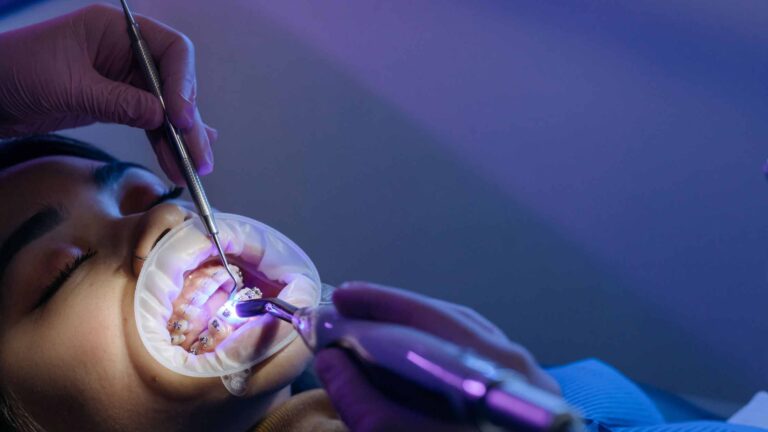 Mouth Rehabilitation with Implants