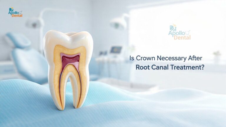 root canal treatment in Nallakunta