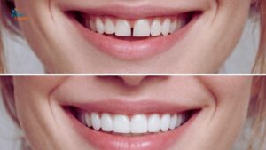 Cosmetic Dentistry in Nallakunta