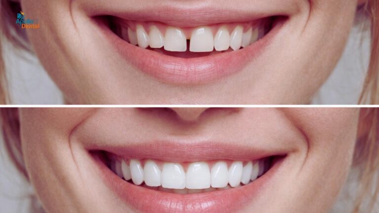 Cosmetic Dentistry in Nallakunta