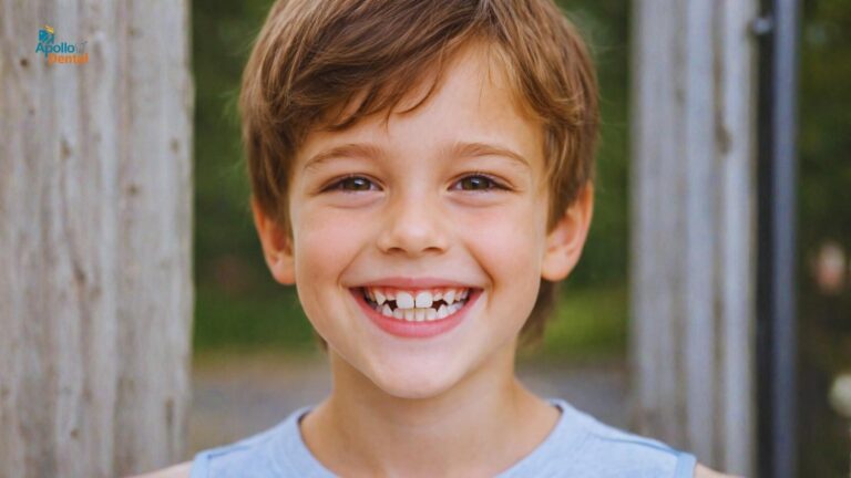 Orthodontic treatment in Nallakunta || Apollo Dental