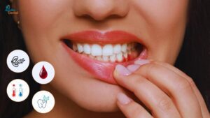 gum infection treatment in nallakunta